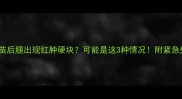 猫咪打疫苗后腿出现红肿硬块可能是这3种情况附紧急处理指南