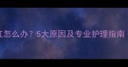 哈士奇眼睛泛红怎么办5大原因及专业护理指南附急救步骤