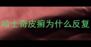 哈士奇皮癣为什么反复