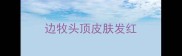 边牧头顶皮肤发红